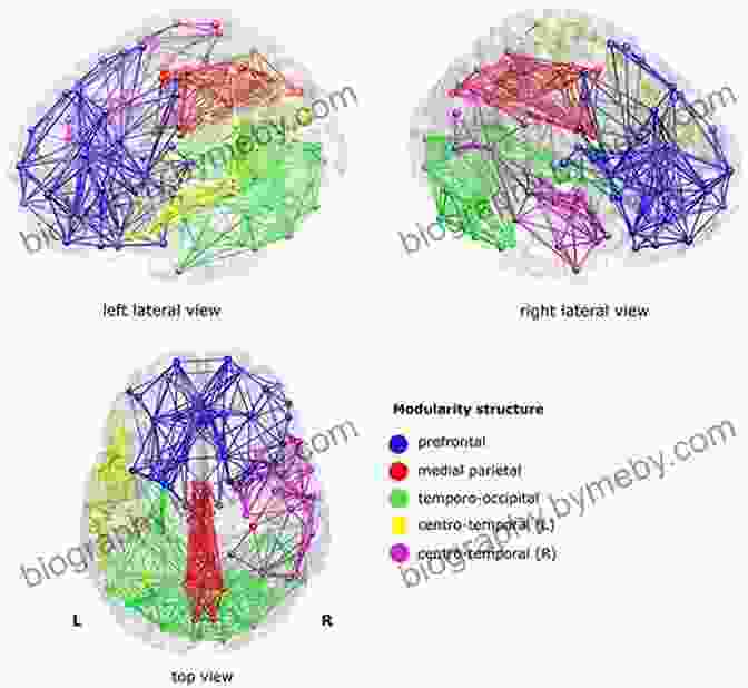 Brain Scan Illustrating Neural Activity Associated With Self Awareness Conscious: A Brief Guide To The Fundamental Mystery Of The Mind