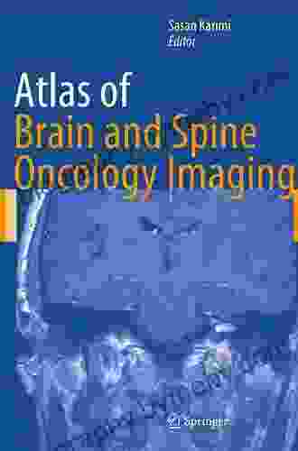 Atlas Of Brain And Spine Oncology Imaging (Atlas Of Oncology Imaging 5)